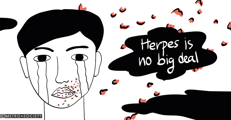 Herpes No Big Deal